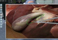 Surgery Simulator 2011 Játékképek 8a60a582d840da6cd3af  