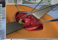 Surgery Simulator 2011 Játékképek ace735b82acd892cc8b7  