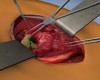 Surgery Simulator 2011 teszt tn