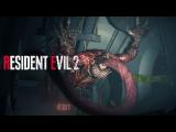Resident Evil 2 - Licker Battle Gameplay tn