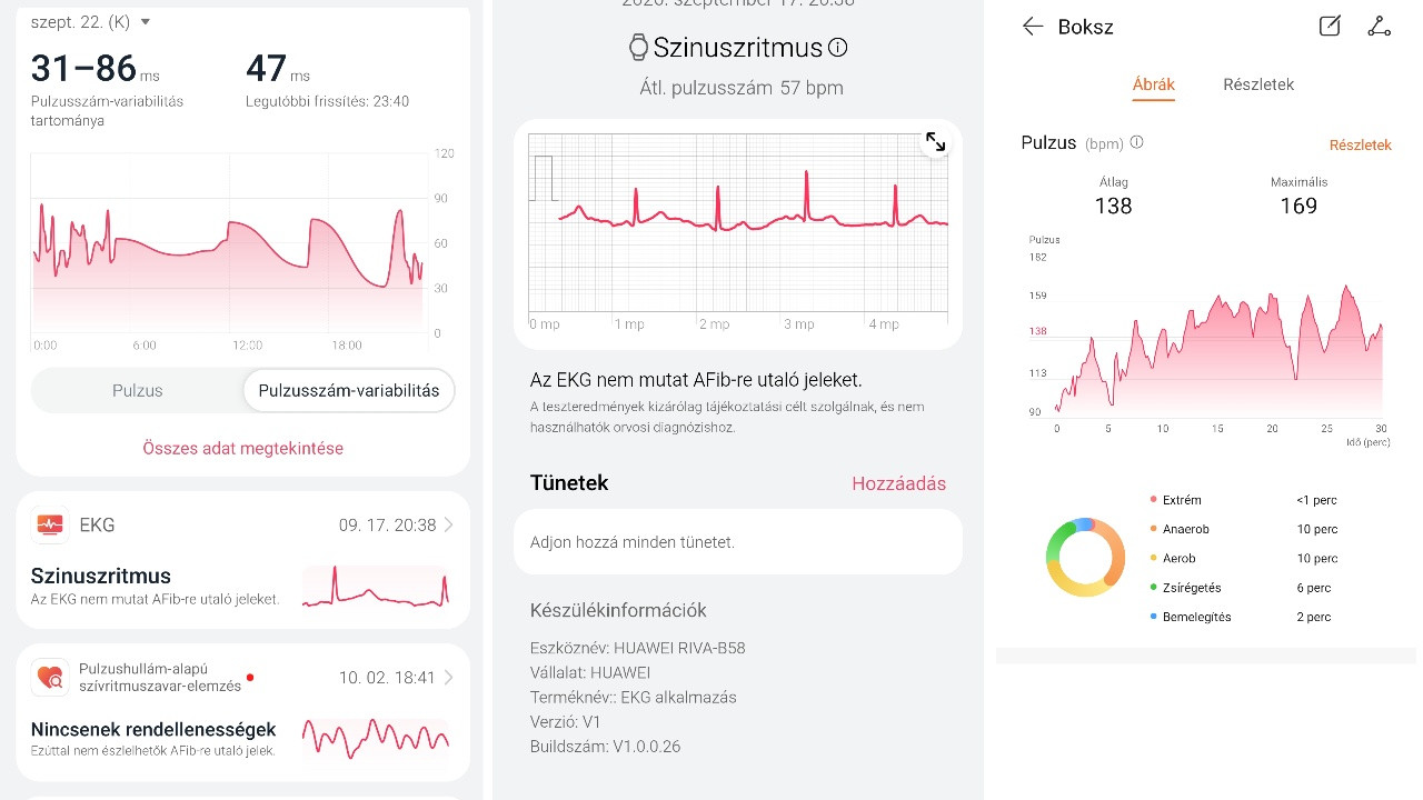 Néztem&nbsp;HRV-t, EKG-t és egy bokszedzésre is magammal vittem az órát.&nbsp;