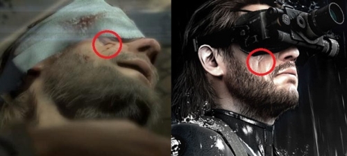 The Phantom Pain: mi vagy te?