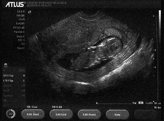 ultrasound-atlas.jpg